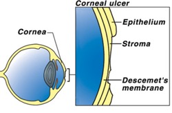 Cat Corneal Ulcer